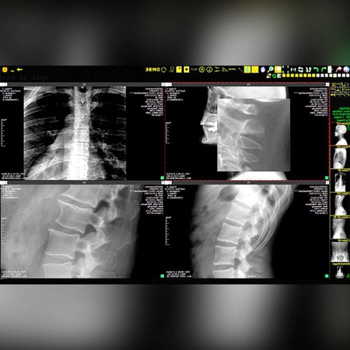 Medical Imaging Transmission System 2