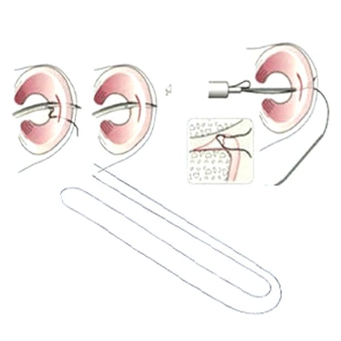 Meniscal Suture Needle 1