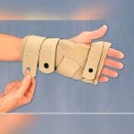 Metacarpal Splint 2