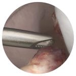 Mini-Invasive Surgery Simulator 2