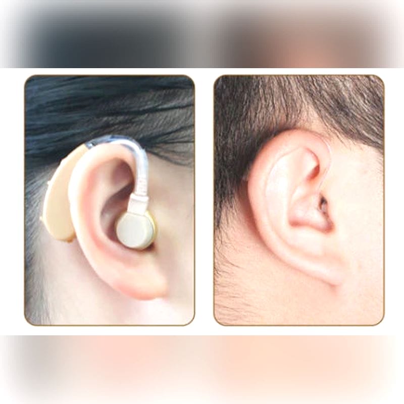 Mini Ric Hearing Aid 1