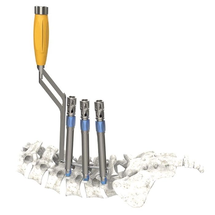 Minimally Invasive Pedicle Screw Positioning System