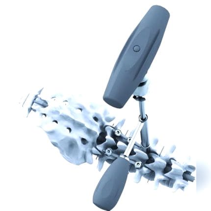 Minimally Invasive Pedicle Screw Positioning System