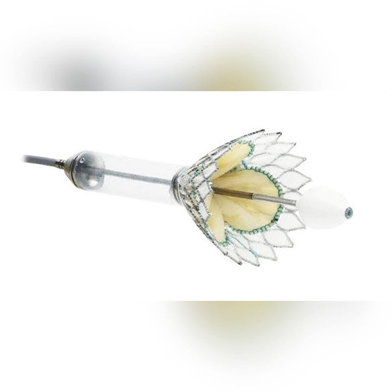 Mitral Valve Bioprosthesis