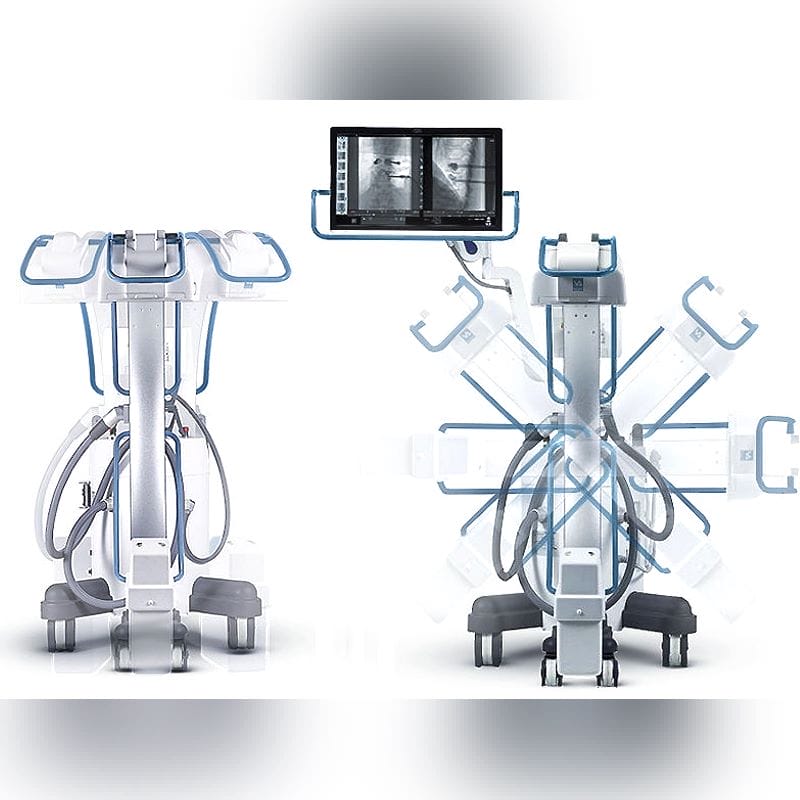 Mobile C-Arm 1