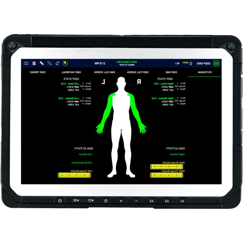 Monitoring Information System