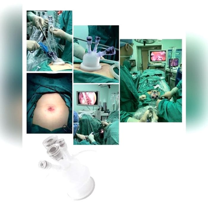 Multi-Instrument Laparoscopic Port 3