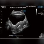 Multi-Purpose Ultrasound Imaging Remote-Controlled Ultrasound System 5