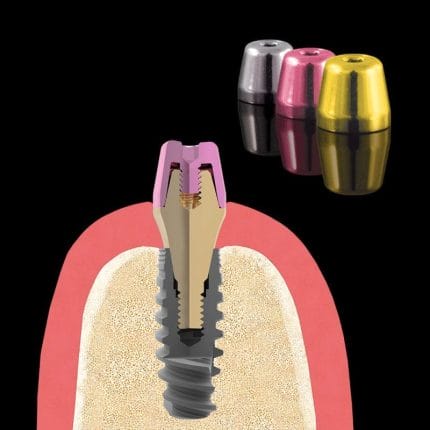 Multi-Unit Abutment Healing Cap