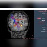 Neurosurgery Software 1