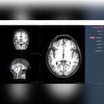 Neurosurgery Software 2