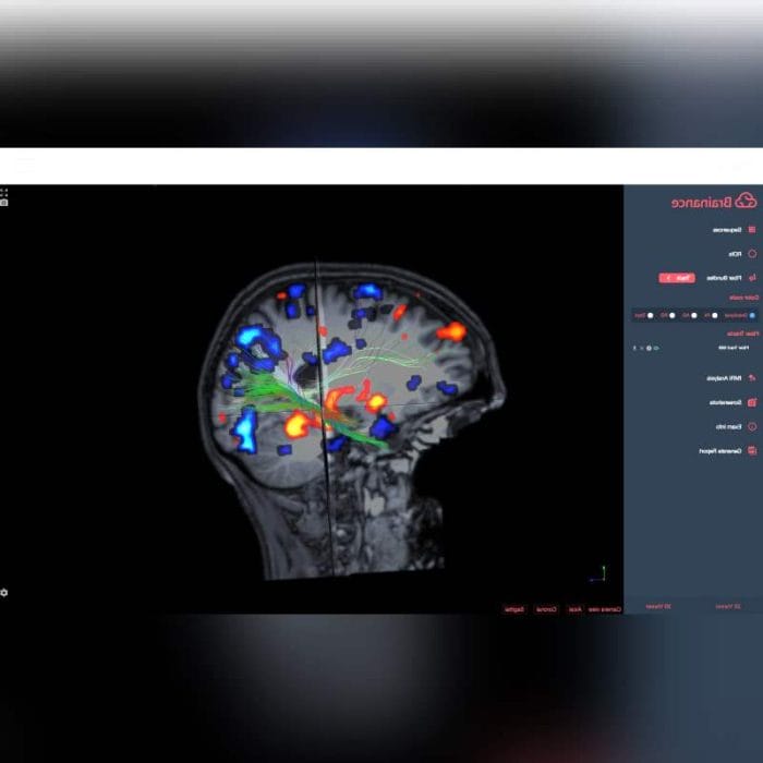 Neurosurgery Software 5