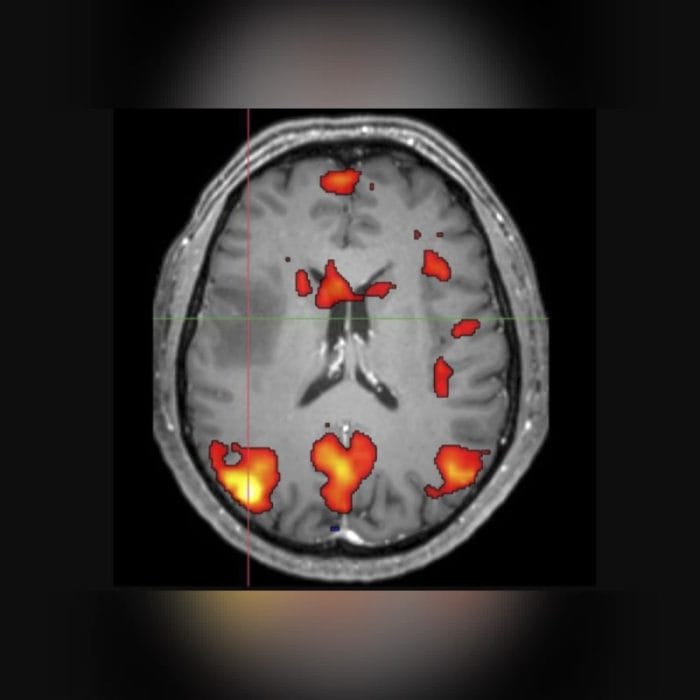 Neurosurgery Software 9