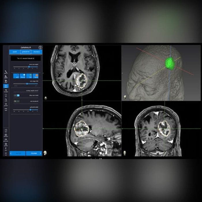 Neurosurgery Surgical Navigation System 4