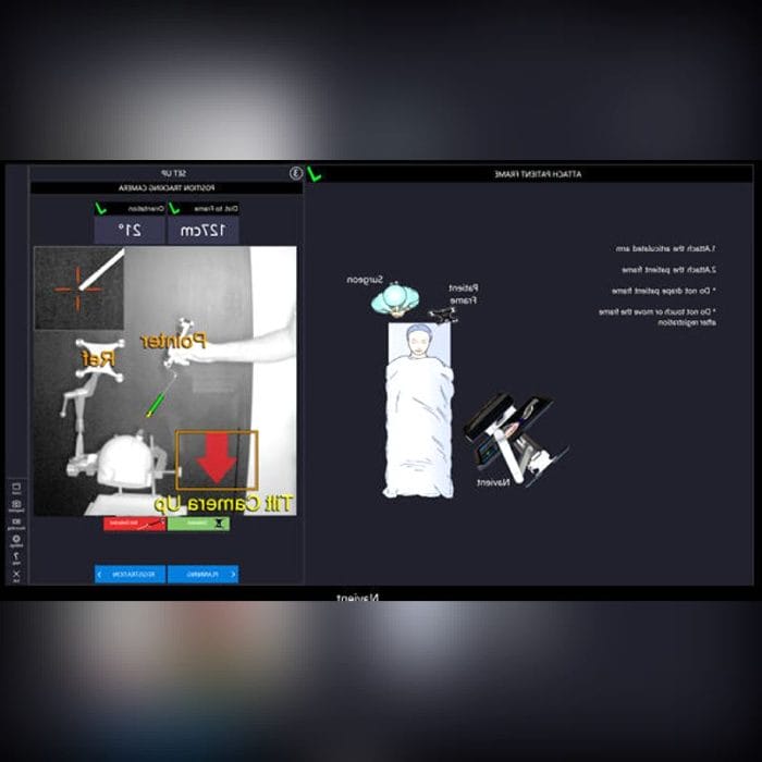 Neurosurgery Surgical Navigation System 5