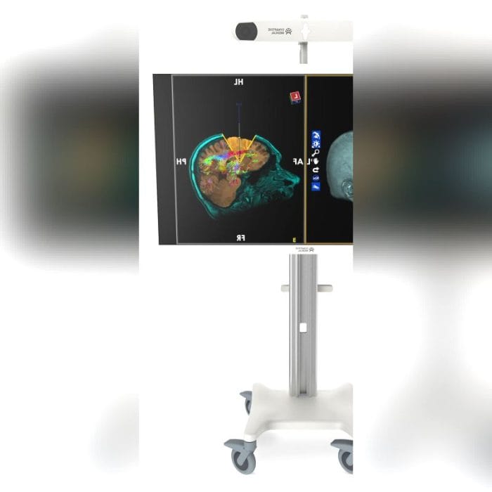 Neurosurgery Surgical Navigation System 1