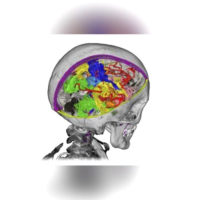 Neurosurgery Surgical Navigation System 2