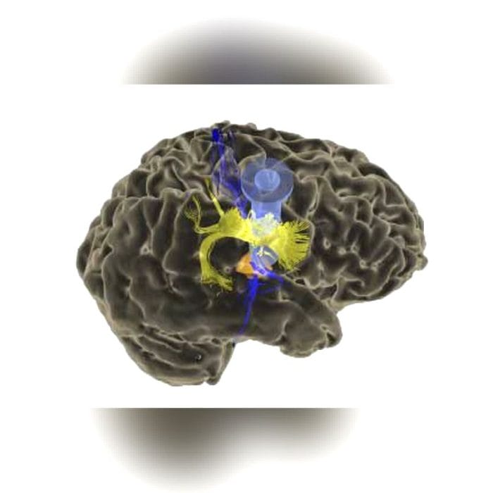 Neurosurgery Surgical Navigation System 3