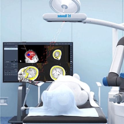 Neurosurgery Surgical Robot 1