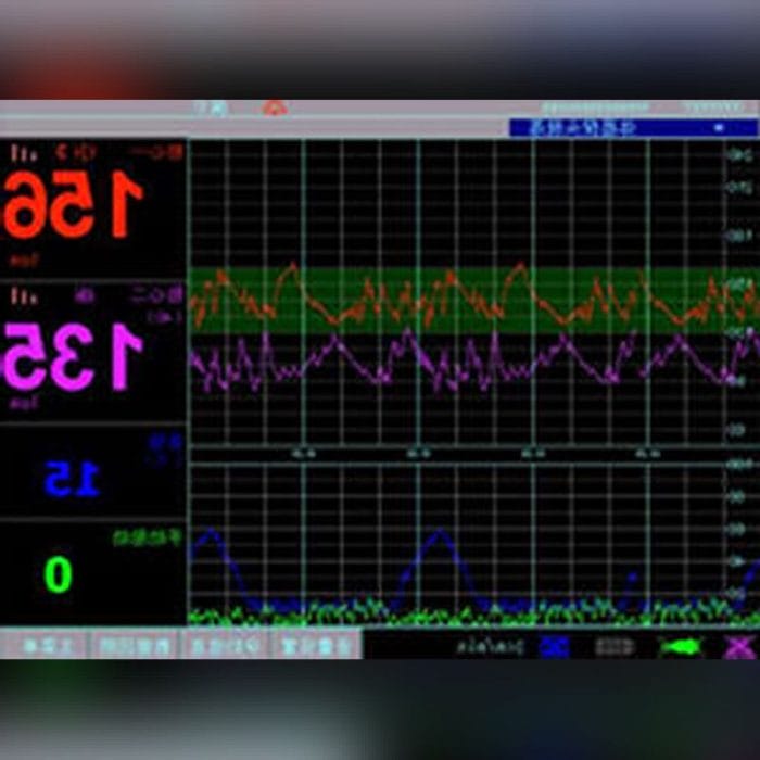 Nibp Fetal Monitor 4