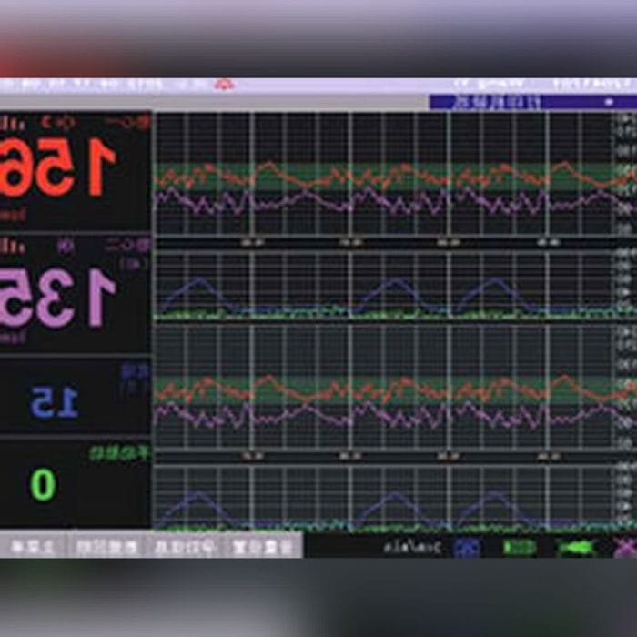 Nibp Fetal Monitor 5