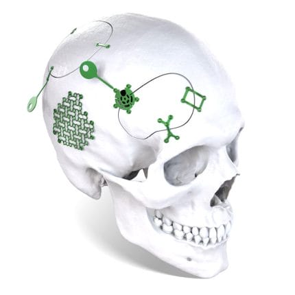 Non-Absorbable Cranial Fixation System