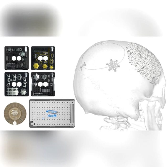 Non-Absorbable Cranial Fixation System