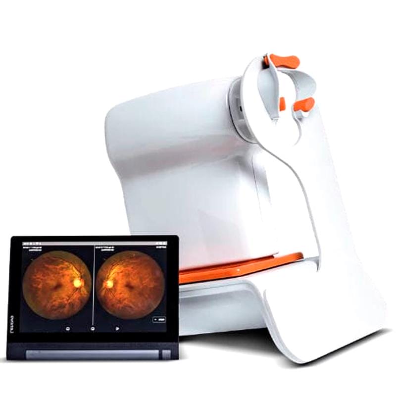 Non-Mydriatic Retinal Camera