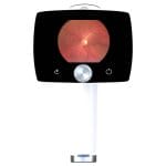 Non-Mydriatic Retinal Camera 2