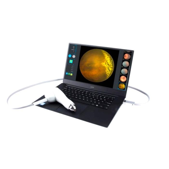 Non-Mydriatic Retinal Camera