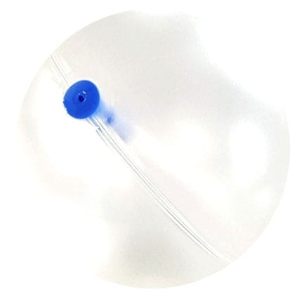 Non-Surgical Intragastric Balloon