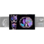 Nuclear Medicine Software