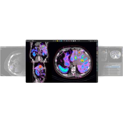 Nuclear Medicine Software