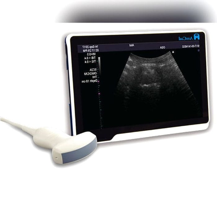 Obstructive Sleep Apnea Detection Remote-Controlled Ultrasound System 3