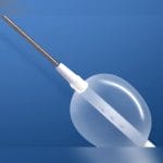 Occlusion Catheter 3