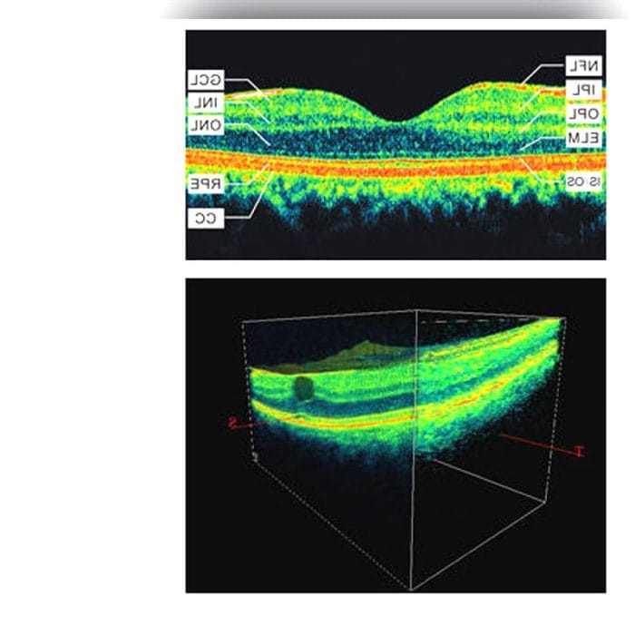 Oct Ophthalmoscope 1