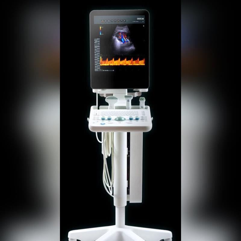 Compact Ultrasound System