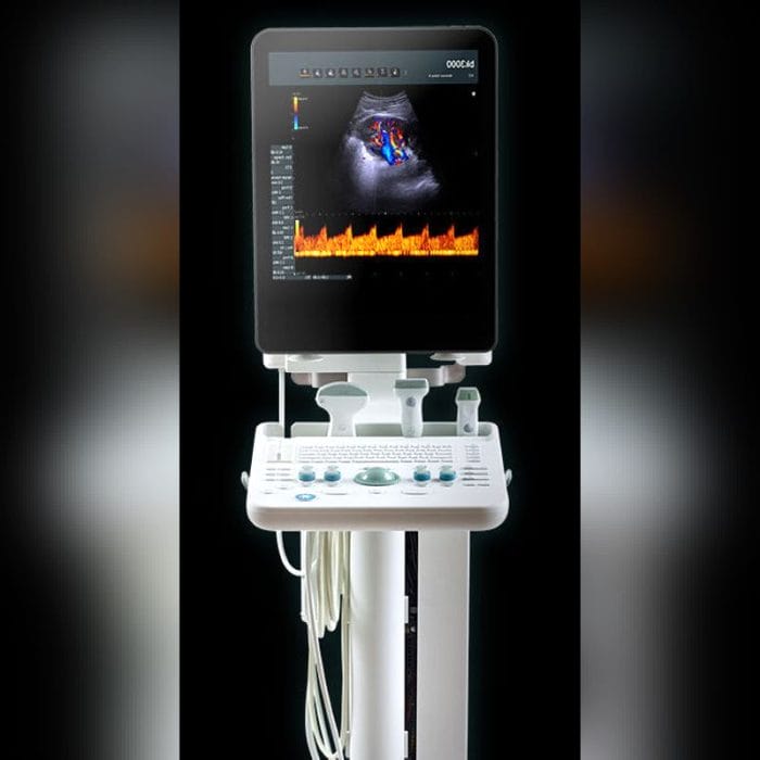 Compact Ultrasound System 1