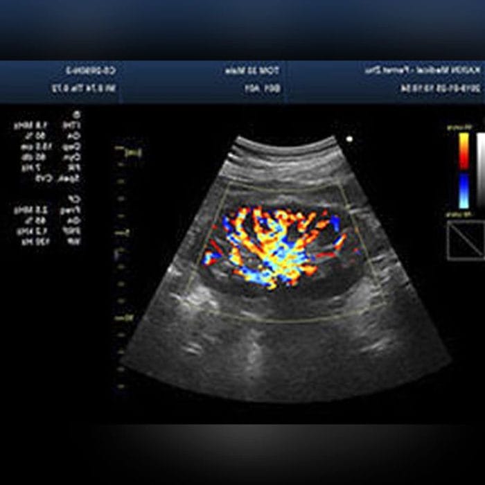 On-Platform Ultrasound System 3