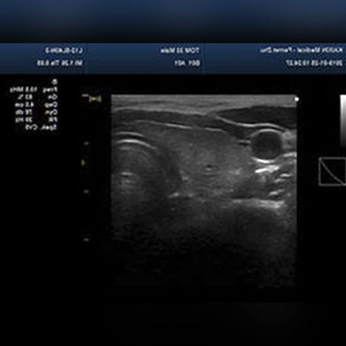 On-Platform Ultrasound System 4