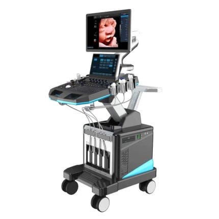 On-Platform Ultrasound System 1