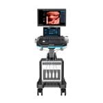 On-Platform Ultrasound System