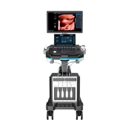 On-Platform Ultrasound System