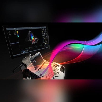 On-Platform Ultrasound System 1