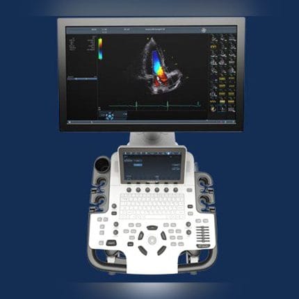 On-Platform Ultrasound System