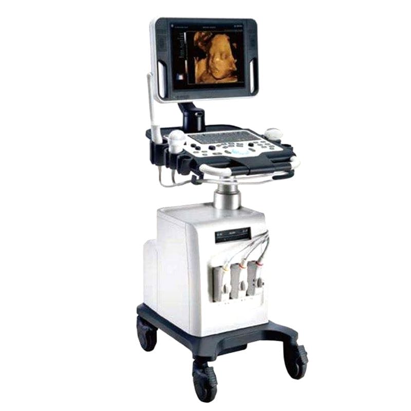 On-Platform Ultrasound System 1