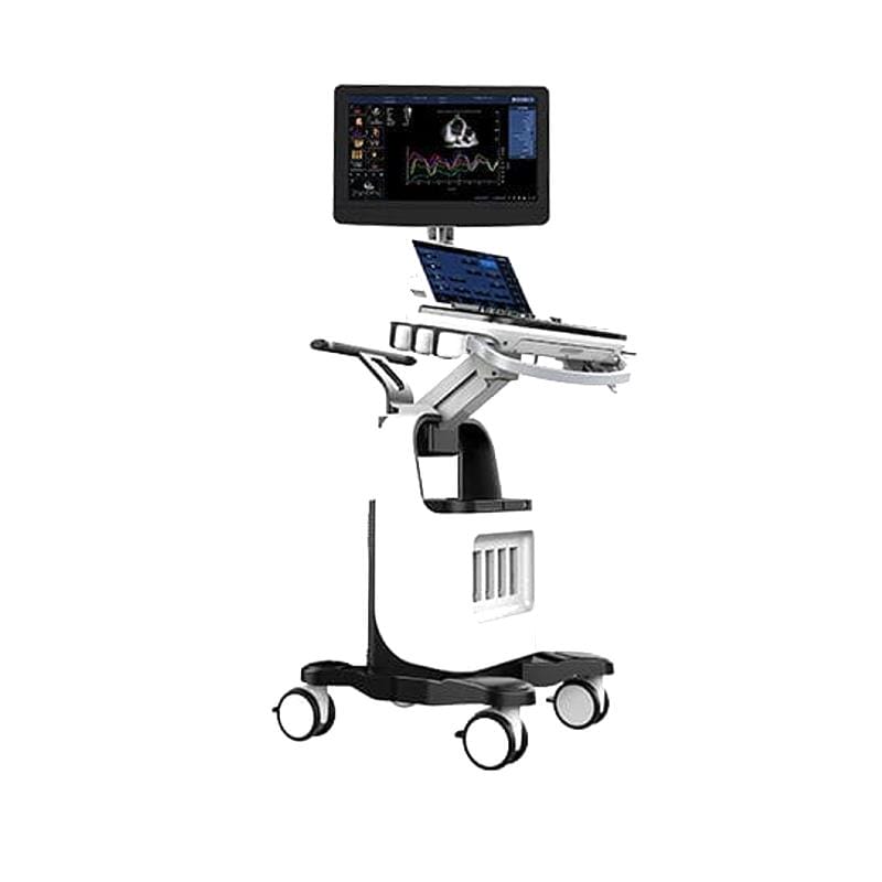 On-Platform Ultrasound System 1