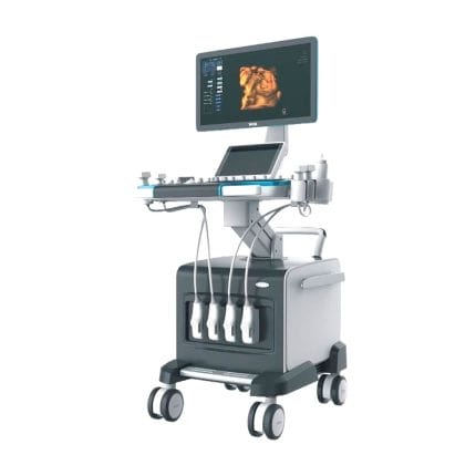 On-Platform Ultrasound System