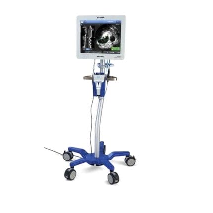 On-Platform Ultrasound System