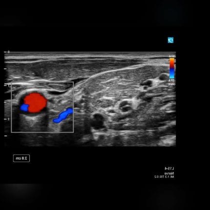 On-Platform Ultrasound System 1